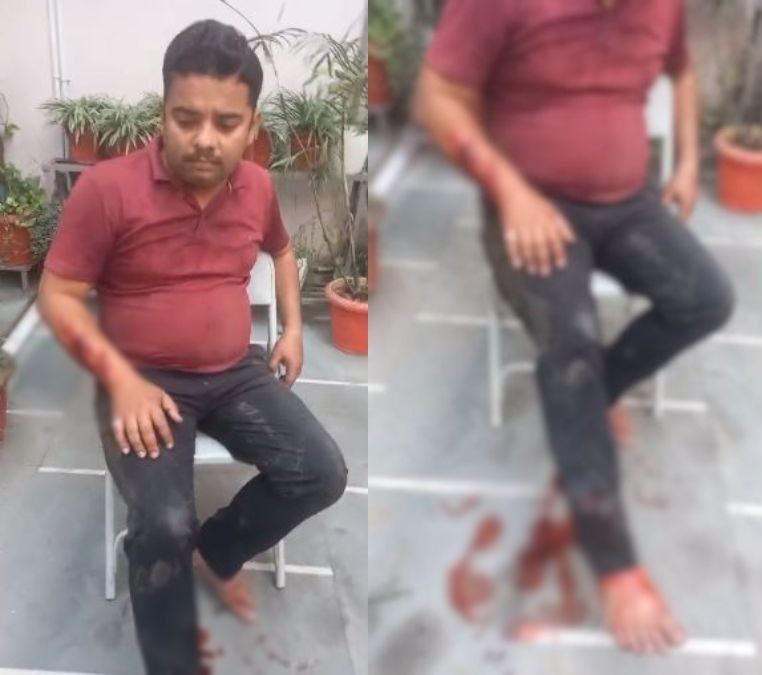 बार-बार हमले, फिर भी खामोशी: रायपुर में पिटबुल डॉग से दहशत